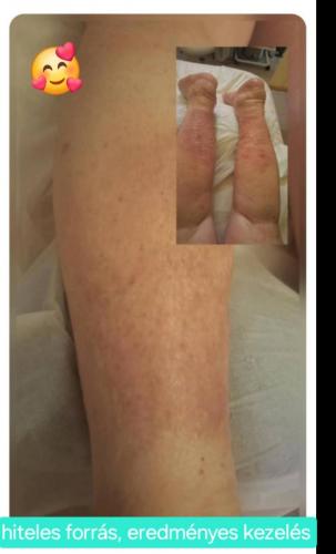 Screenshot 20260125 110815 Facebook (1)