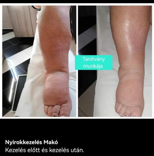 Screenshot_20260125_111114_Facebook