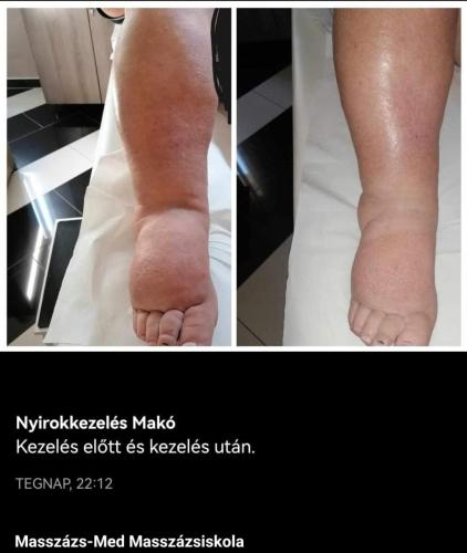 Screenshot 20250329 071635 Facebook
