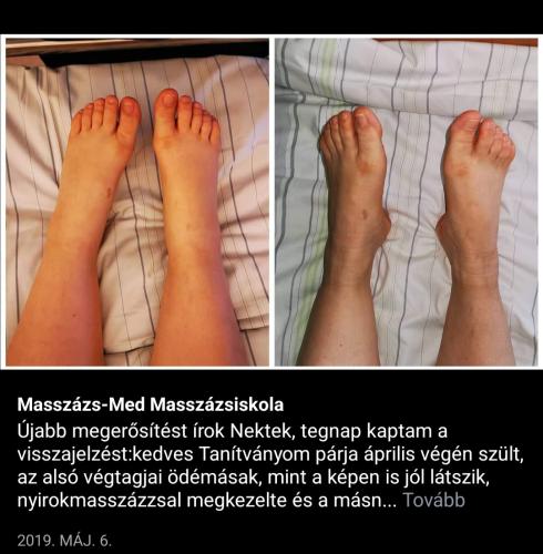 Screenshot 20250329 072554 Facebook